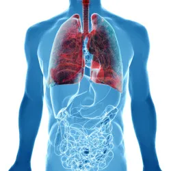 human body under X-rays isolated on white with highlighted lung cancer