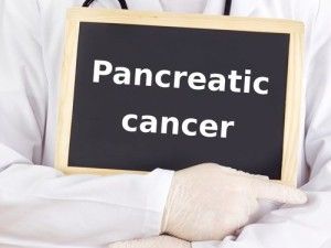 pancreatic-cancer-onglyza