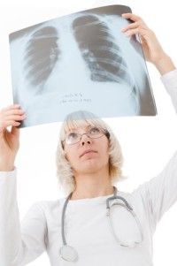 asbestos-mesothelioma-appeal