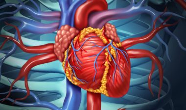 Bard IVC filter