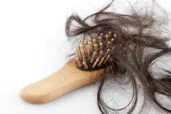 Hair loss caused by Taxotere is permanent