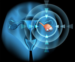 talcum-baby-powder-ovarian-cancer