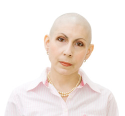 Taxotere Hair Loss
