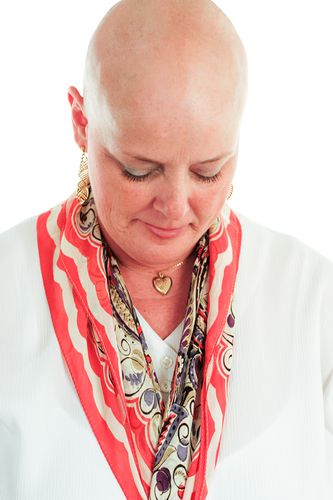 woman loses hair after chemotherapy