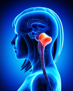 Dilantin linked to cerebellar atrophy