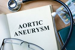 Aortic Aneurysm
