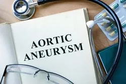 Aortic Aneurysm
