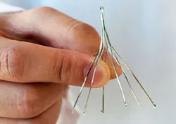 Blood Clot Filter Removal