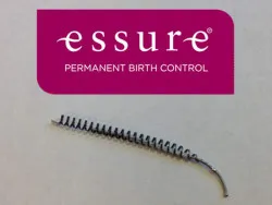 Essure Birth Control