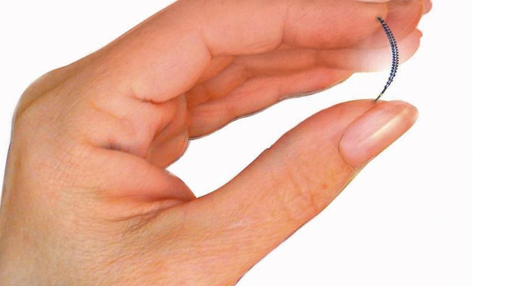 Essure-Birth-Control