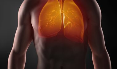 Mesothelioma cancer