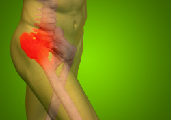 Hip Implant Failure