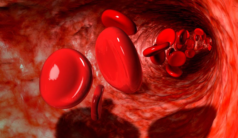 Blood in vein IVC filter