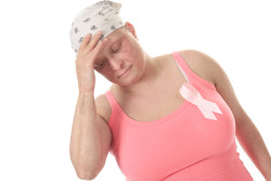 Taxotere-hair-loss