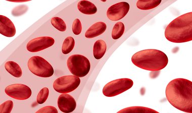 Filter-For-Blood-Clots