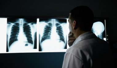 whistleblower awards for x-ray techs