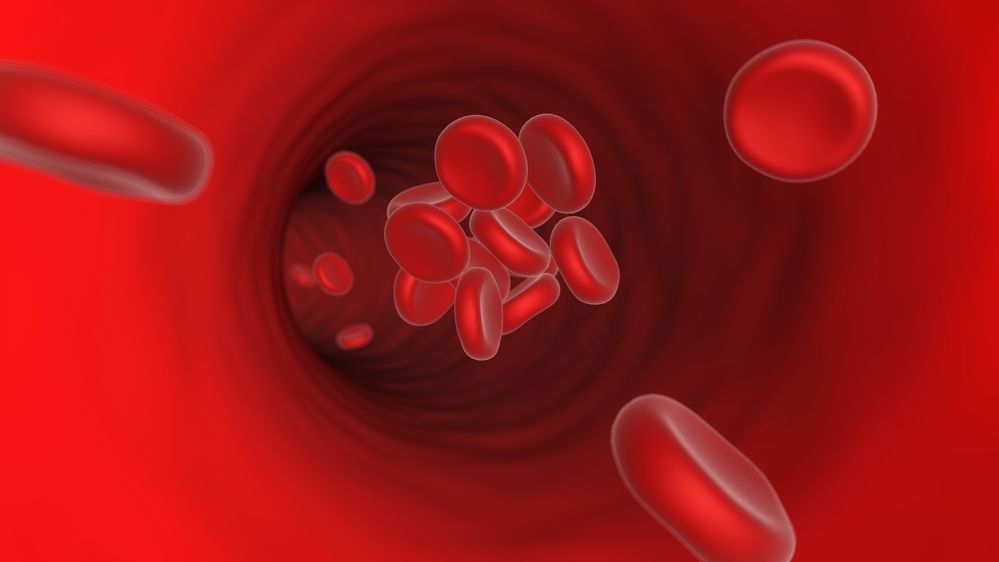 IVC-filter-blood-clot
