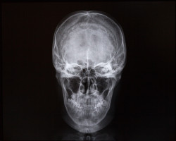 X-rays of skull and internal cavity. Medicine