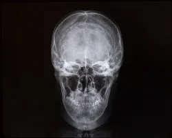 X-rays of skull and internal cavity. Medicine