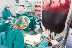 Eliquis Internal Bleeding