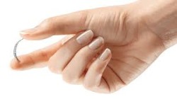 Essure-Birth-Control