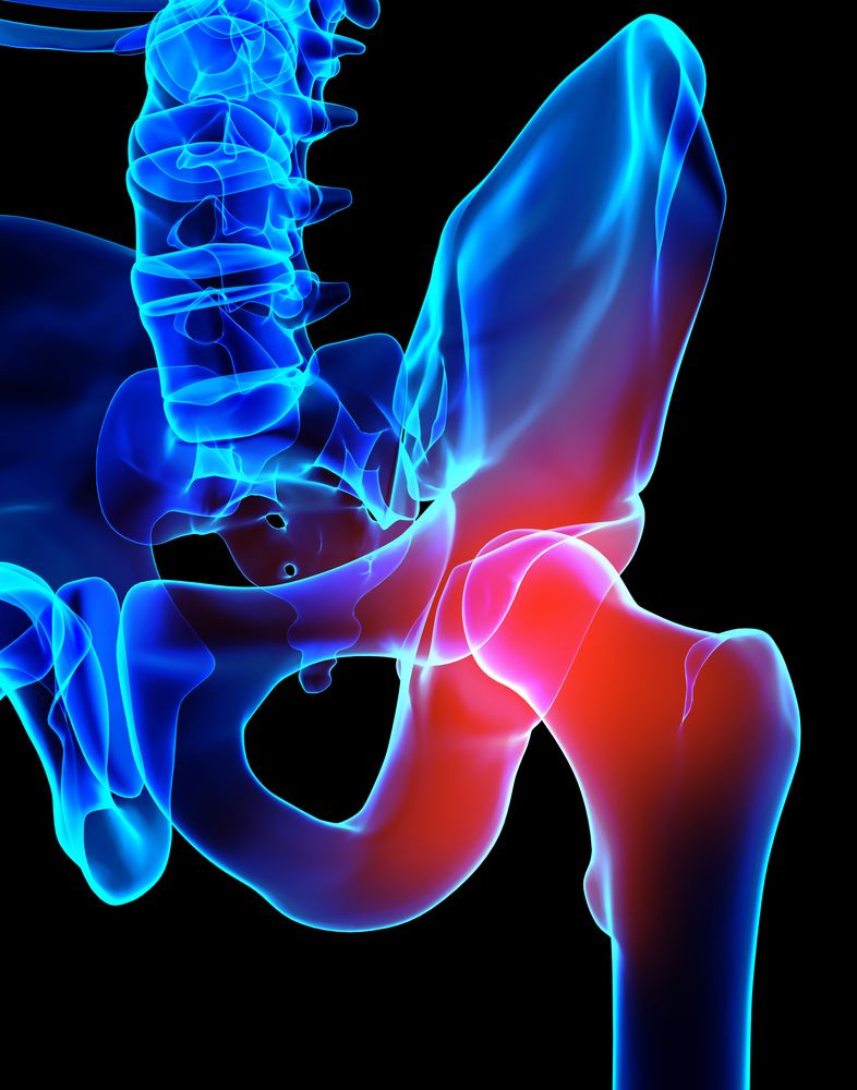 DePuy-ASR-hip-replacement-settlement
