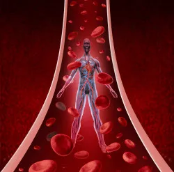 IVC-Filter-Lawsuit