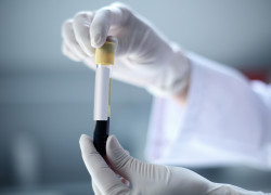 Xarelto Blood In Urine