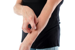 Zithromax Stevens Johnson Syndrome