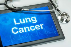 Asbestos Lung Cancer