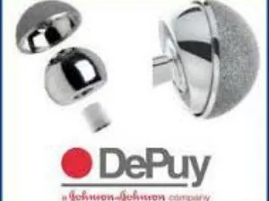 DePuy-ASR-stem-revision