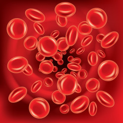 Blood-Clot-Filter-Lawsuit