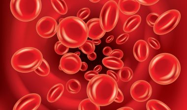 Blood-Clot-Filter-Lawsuit