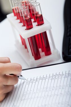 Doctor's medical notes and blood samples