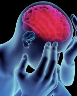 Dilantin Cerebellar Atrophy