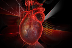 IVC Filter Side Effects