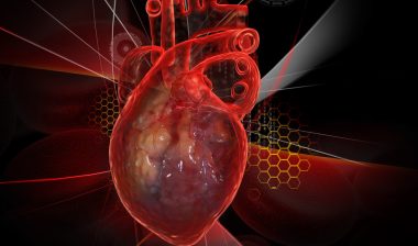 Consumer Claims IVC Gunther Tulip Filter Can Cause Serious Complications