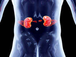 Nexium-kidney-disease
