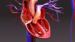 ivc-filter-lawsuit