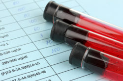 Blood in test tubes and results close up
