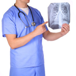 IVC filter complications pulmonary embolism
