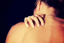 skin reaction rash Stevens Johnson syndrome SJS