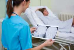 Dilantin Cerebral Atrophy Diagnosis