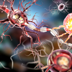 dilantin cerebral degeneration