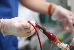 After blood transfusion