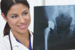 Stryker Metal Hip Recall