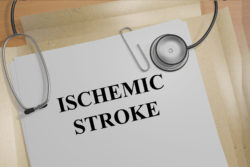 Xarelto Ischemic Stroke