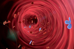 IVC filter complications
