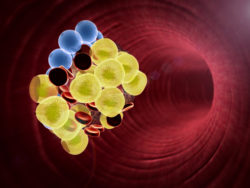 blood clot