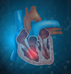 heart, clot